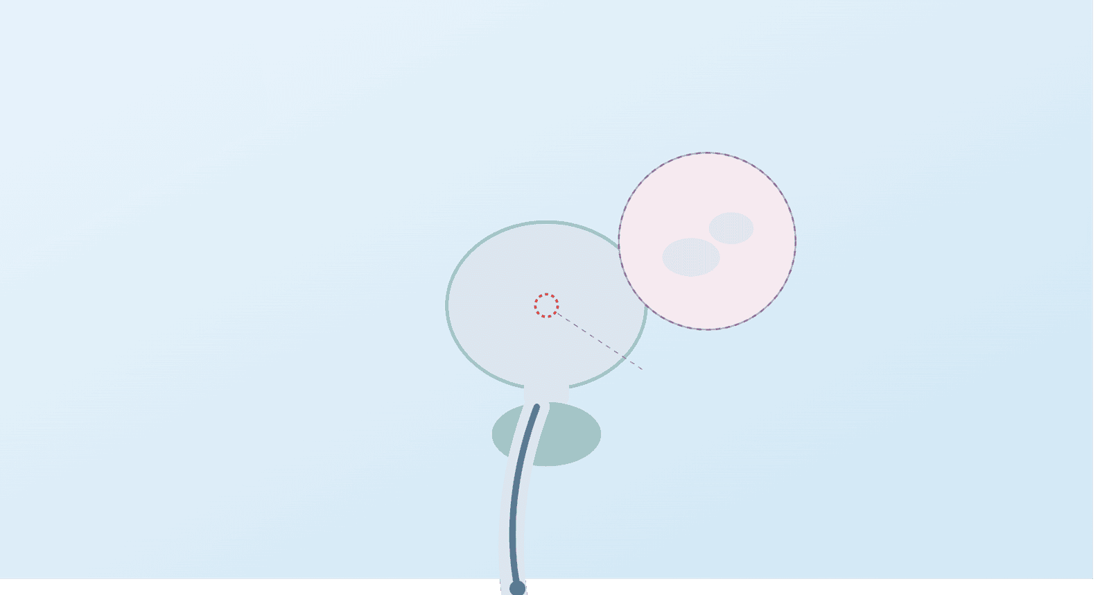 Flexible cystoscopy